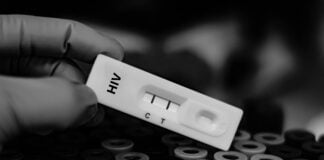 Blood sample of patient positive tested for anti-HIV by rapid diagnostic test.