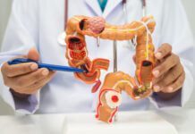 Black Hoosiers urged to get screened as colorectal cancer awareness month beginsĀ